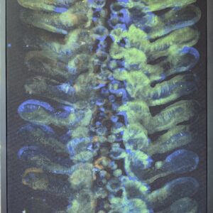 Spine